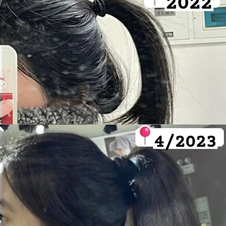 Alternative view of Xịt Chống Rụng Tóc Kích Thích Mọc Tóc