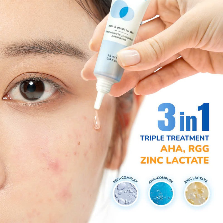 Alternative view of Combo 2 Tuýp Gel Giảm Mụn Thâm Sẹo Neothera Acnes
