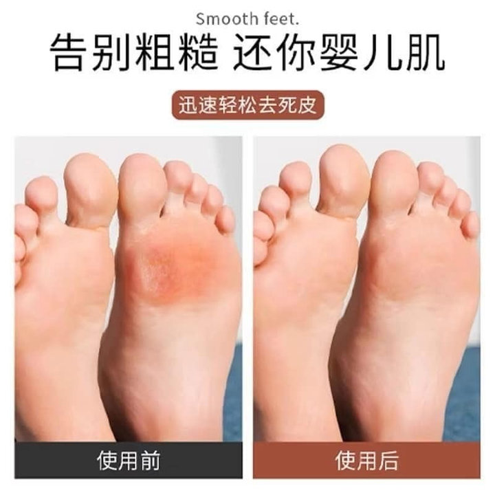 Alternative view of Chà Gót Có 2 Mặt, Dùng Cho Mọi Người Siêu Tiện Lợi